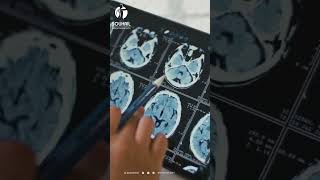 Comprendre la Radiographie  Une Fenêtre sur Votre Santé 💡🔍 [upl. by Lindahl602]