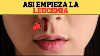 Que es la LEUCEMIA Causas Sintomas y Tratamiento [upl. by Lewellen459]