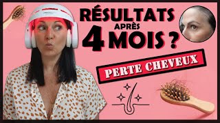 👩 CASQUE LED CHEVEUX  MON BILAN 👩 avantaprès [upl. by Aerdnak]