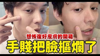 【開箱】手賤把臉摳爛了！？拯救爛臉鈞，開箱ULIKE美容儀！ 開箱找秉鈞 [upl. by Lua]