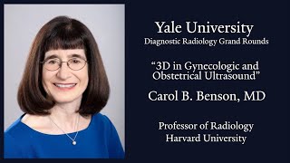 3D in Gynecologic and Obstetrical Ultrasound [upl. by Naened686]