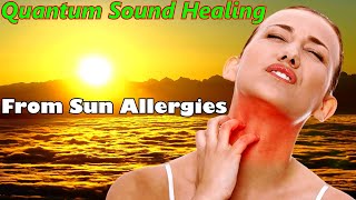 Allergy to the sun  Quantum Sound Healing  Matrix  Peter Petrovich Garyaevs  Science  the sun [upl. by Egor418]