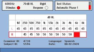Testing with the RA360 audiometer [upl. by Vassili]