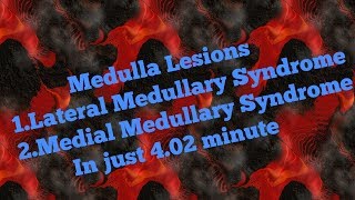 Medulla lesionsMedial and Lateral Medullary Syndrome IN Hindi [upl. by Hbaruas]