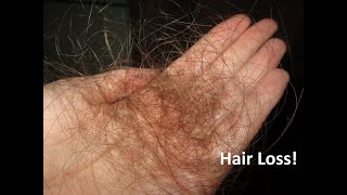 Doctor Discusses Most Common Cause of Sudden Hair Loss [upl. by Lacagnia]