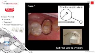 Dr Trost on KnitPak Traxodent amp Retraction Caps [upl. by Eesyak]