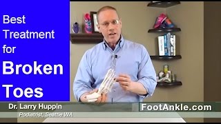 What is the Best Treatment for a Broken Toe and why you should NEVER buddy tape a stubbed toe [upl. by Ennovart]