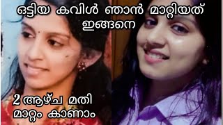 കവിൾ വണ്ണം കൂട്ടാൻ ഡോക്ടർ പറഞ്ഞു തന്ന വഴിlRamyasujayI How to Get Chubby Cheeks with out Excercise [upl. by Northrop]