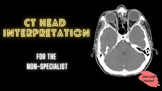 CT Head Interpretation [upl. by Lassiter]