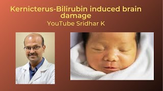 Kernicterus and BIND bilirubin induced neurologic damage Dr Sridhar K [upl. by Seroka]