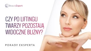 Czy po liftingu twarzy pozostają widoczne blizny Porady eksperta [upl. by Matilda]