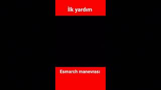 İlk yardım esmarch manevrası [upl. by Ahtenek]