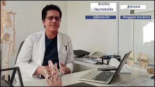 8 Síndromes Articulares Inflamatorio Artritis Reumatoidea [upl. by Nesaj]