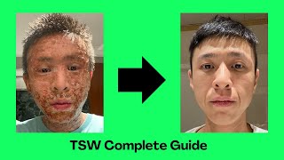 TSW Complete Guide Survivors Guide to Topical Steroid Withdrawal [upl. by Scales6]