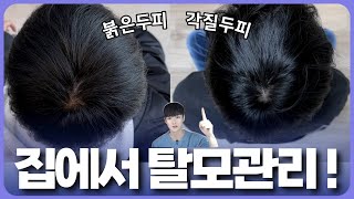 집에서 하는 탈모두피 관리 l 꾸준히 직접 해본 리필드 6주 후기 공개 [upl. by Turro]