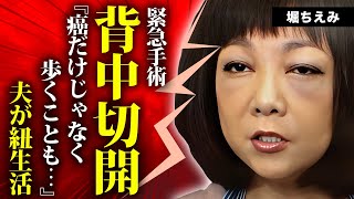 堀ちえみがquot背中切開quotしてquotボルト埋込手術quotの真相…顔面崩壊した切ない姿に言葉を失う…『リ・ボ・ン』がヒットした女性歌手の再婚夫が会社をクビになった原因息子2人と音信不通の理由に驚きを隠せない… [upl. by Eisele]