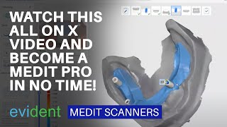 AllonX Workflow with Medit Scanners [upl. by Karoline]