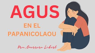 AGUS en tu papanicolaou [upl. by Haisoj]