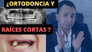 Ortodoncia con raíces cortas ¿PERDERÉ MIS DIENTES [upl. by Hsizan407]