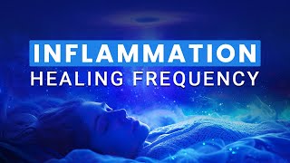 Inflammation Healing Frequency Heal Wounds amp Inflammation While Sleep [upl. by Harret663]