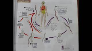 life cycle of strongyloides nematode [upl. by Maddocks]