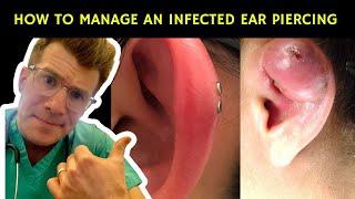 How to recognise manage and treat an infected ear piercing  Doctor ODonovan explains [upl. by Nosretep]