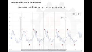 HSCOPE 402  ENTENDIENDO LA SEÑAL DE VACÍO EN ADMISIÓN [upl. by Alihs]