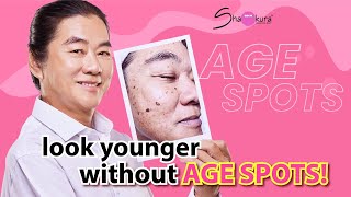 Shakura让我不一斑！Say goodbye to age spots melasma freckles sunspots and postpartum pigmentation！ [upl. by Fevre]