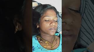 hydrafacialtreatment chennai [upl. by Bradstreet]