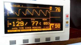 Propaq 100 102EL patient monitor Part 1 [upl. by Oetsira]