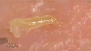 Big Nasty Ear Blackheads Dilated Pores of Winer Extravaganza [upl. by Yadseut]