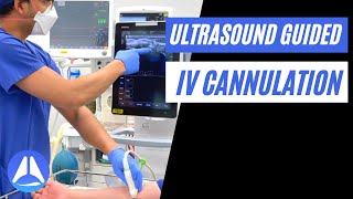 Intravenous IV Cannulation under Ultrasound US guidance  5 steps to optimise your view [upl. by Joiner]