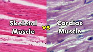 Differentiating Skeletal Muscle and Cardiac Muscle  Striations vs Intercalated Discs [upl. by Nyraf]