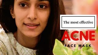 MOST EFFECTIVE ACNE FACE MASK  ACNE  SKINCARE  ERICA FERNANDES [upl. by Shirah]