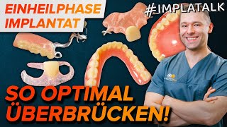 Provisorium nach Implantation  So überstehst du die Einheilphase optimal [upl. by Nandor]