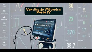 Ventilación Mecánica IV uci ventilaciónmecánica terapiarespiratoria critico cuidadointensivo [upl. by Auston]