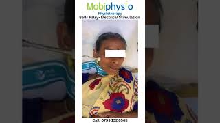 Bells Palsy Treatment  Physiotherapy  Electrical stimulation bellspalsy stimulation mobiphysio [upl. by Engedus595]