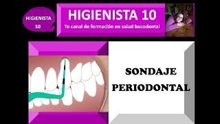 SONDAJE PERIODONTAL TEMARIO GENERAL 25 [upl. by Karilla]