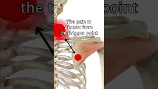 Infraspinatus Trigger Points [upl. by Sabanrab]