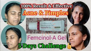 Femcinol A Gel Review Telugu femcinoalAgel pimples acne skincaretips skincare review telugu [upl. by Haze]