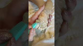 Full foot callus removal  Epidermolytic Palmoplantar Keratoderma  Jan 30 2023 [upl. by Sivaj]