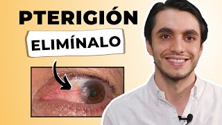 ✅ El MEJOR TRATAMIENTO para el PTERIGIÓN 💡¿Cómo ELIMINARLO con el Método PTR ÚNICO [upl. by Clevey]