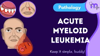 Acute Myeloid leukemia General pathology Examination Diagnosis Classification  Treatment [upl. by Cope]