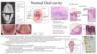 Pathology Made EasySystemic Pathology 15Head amp Neck Diseases2Oral cavity diseases1 [upl. by Ritchie]