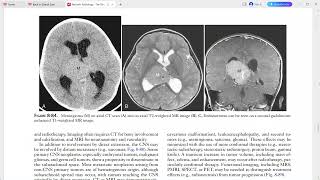 PAEDIATRIC IMAGING [upl. by Obeded]