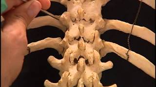 Video 4 Extrapedicular thoracic [upl. by Anawek831]