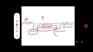 Q Describe different waves and uses of EEG [upl. by Trawets596]