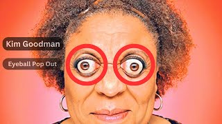 Kim Goodman  The Woman Who Can Pop Her Eyeballs Out  Eyeball Protrusion  Eyeball Pop Out [upl. by Cutter604]