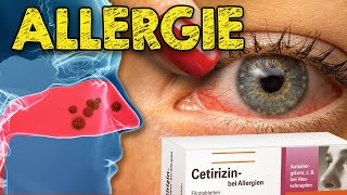 Allergien Deswegen reagiert dein Immunsystem über  Effektive Ansätze zur Linderung [upl. by Racso646]