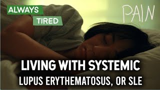 Systematic Lupus Erythematosus SLE I Signs and Symptoms  How to Deal with Living with SLE [upl. by Sletten157]